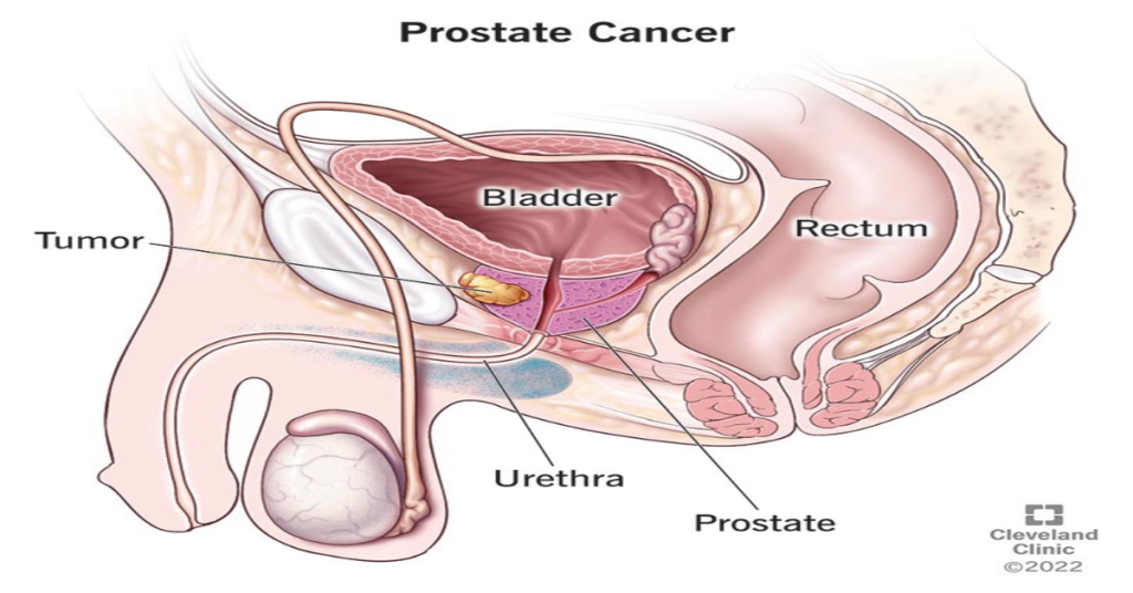 20 Super foods to Savor for a Healthy Prostate: A Delicious Roadmap to Better Men’s Health