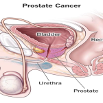 20 Super foods to Savor for a Healthy Prostate: A Delicious Roadmap to Better Men’s Health